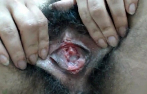 Girl is masturbating monster hairy pussy. Vagina juice dripping from hairy lips of vagina